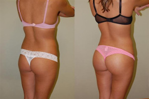 Name:  How-to-Muscle-Your-Butt-Quickly-2522.jpg
Views: 1193
Size:  14.7 KB